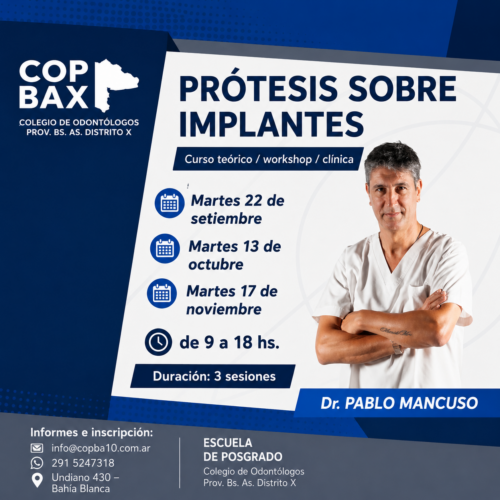 PRÓTESIS SOBRE IMPLANTES